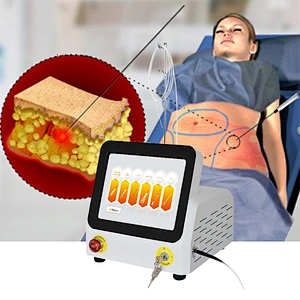 NEW 1470nm Diode Endolaser Equipment Micro Plastic Surgery 1470nm Lipolysis Laser Machine Endolift Laser Machine