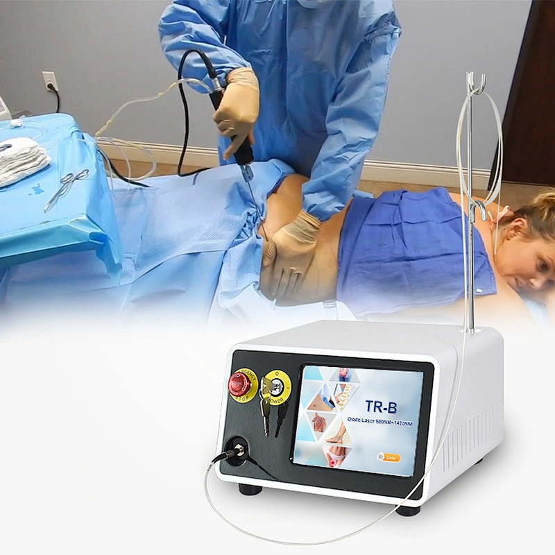 2025 Newest Professional 980nm Slimming Vaser Laser Liposuction Surgery Machine Remove Stubborn Body Cellulite