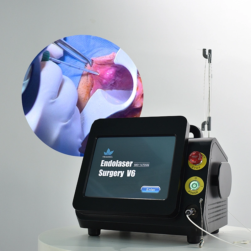 980nm1470nm Proctology Surgical Treatment Machine High Power Removal Fistula Hemorrhoids Pilonidal Sinus