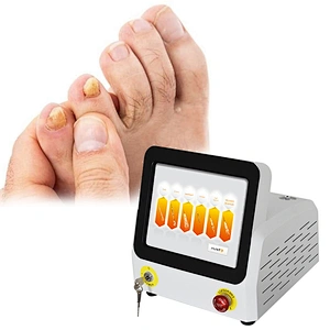 Class IV Laser 980nm  Podiatry Laser for Nail Fungus Onychomycosis Laser Toe Nail Fungus Treatment Machine