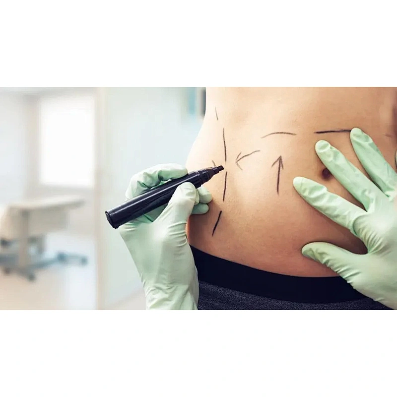 2023 Most Popular 980nm Facelift Bodycontouring Liposuction Lipolysis Machine