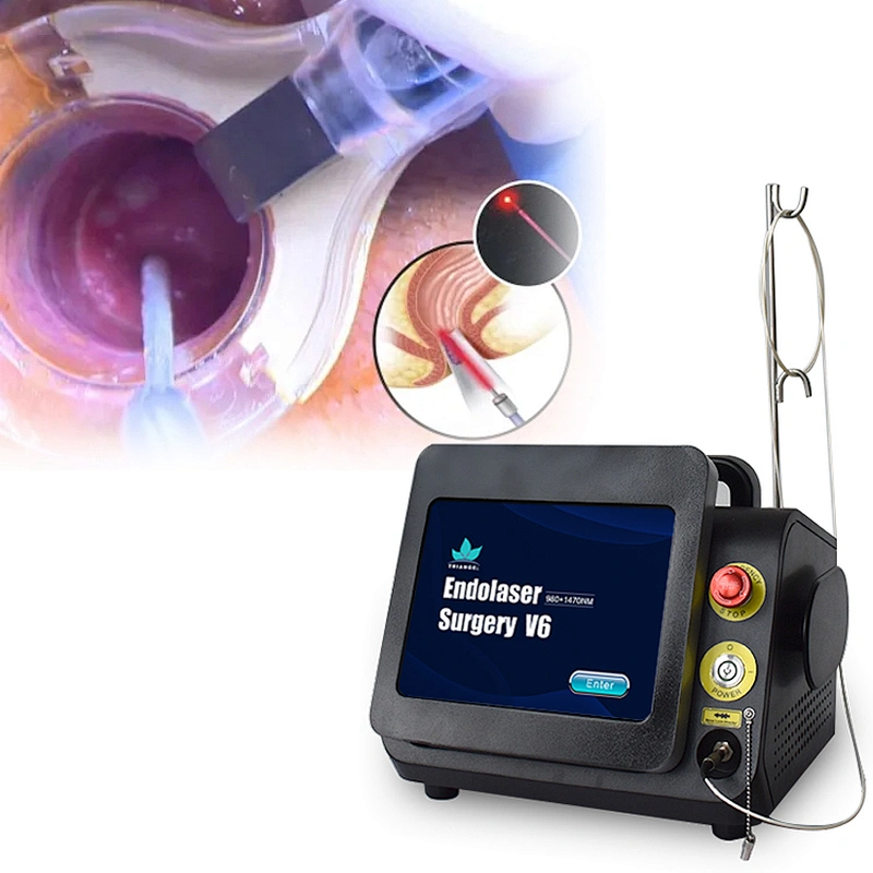 980nm1470nm Minimally Invasive Treatment Device Diode Hemorrhoidectomy Laser