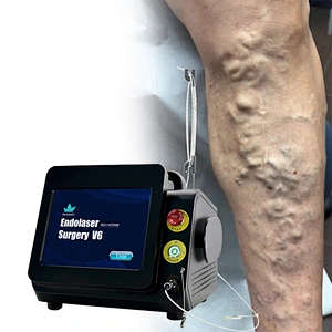 Laser Evlt Vascular Surgeon 1470nm EVLT Treatment EVLA Laser Legs Care Varicose
