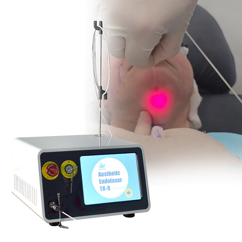 2025 Newest 980nm 1470nm Medical Diode Laser Vaser Liposuction Machine Endolaser Facial Lifting/Remove a Double Chin