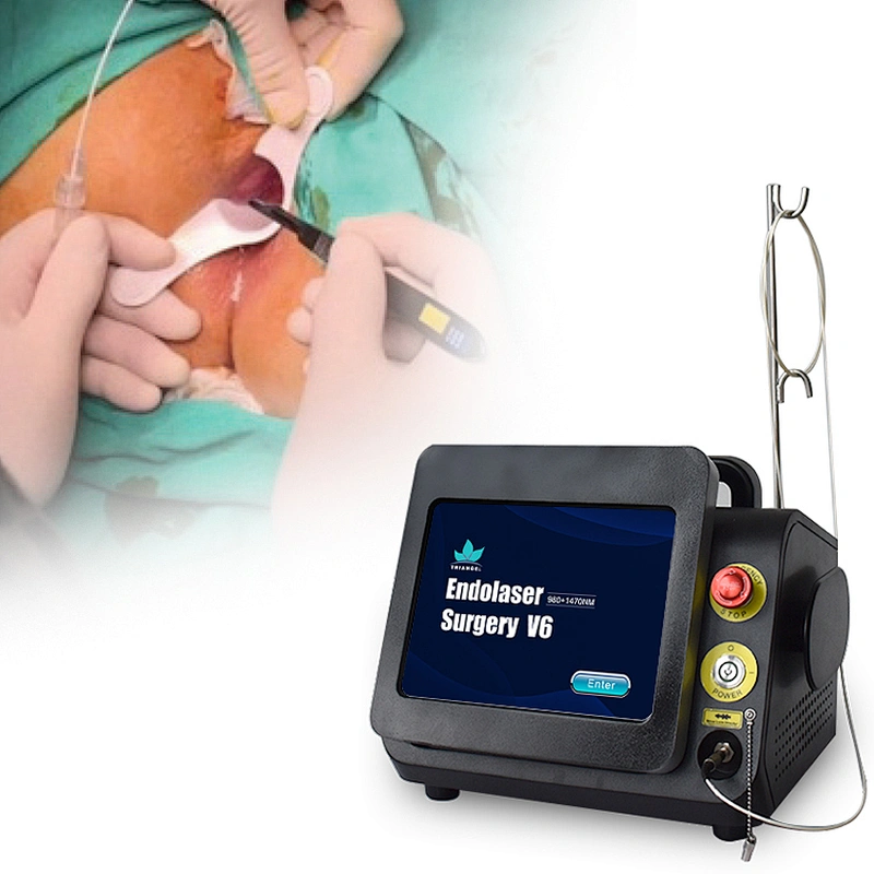 980nm1470nm Minimally Invasive Treatment Device Diode Hemorrhoidectomy Laser