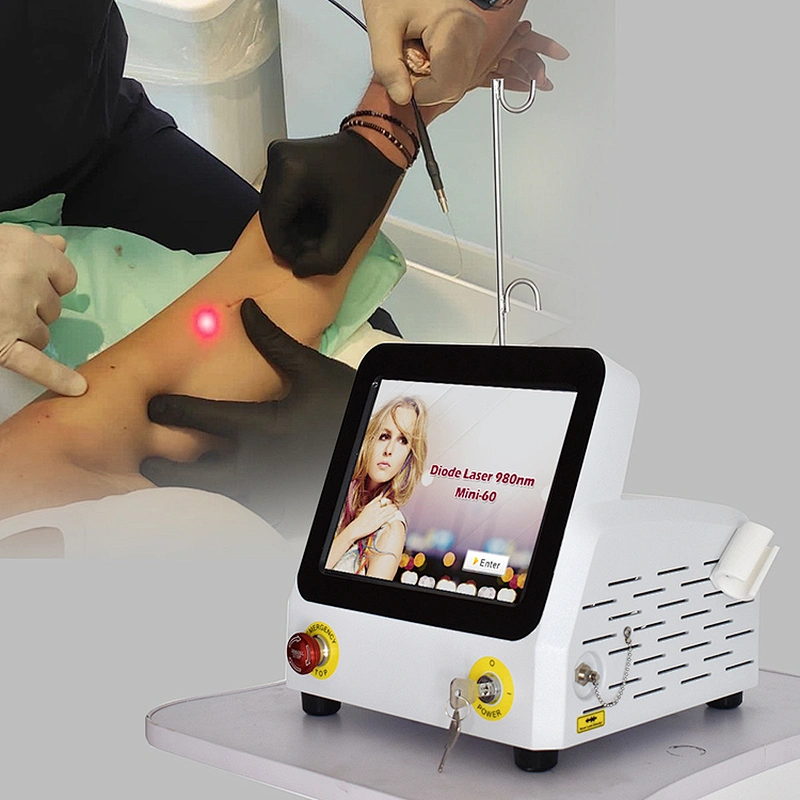 980nm Lipolysis Facial Lifting Endolaser Lipolaser De Diodo Device Plastic Surgery Fiber Laser Beauty Machine