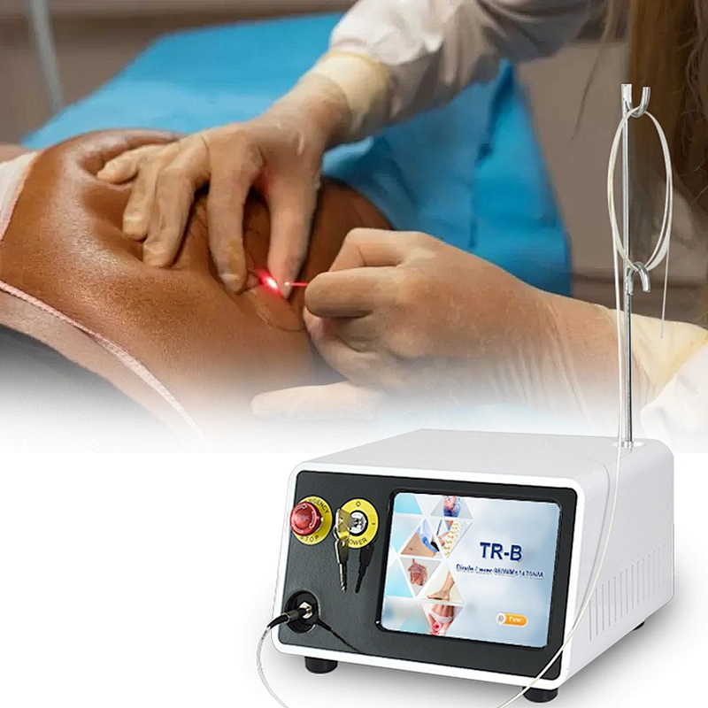 2024 Newest Endolaser 1470nm 980nm Diode Laser Face Lifting Liposuction Machine