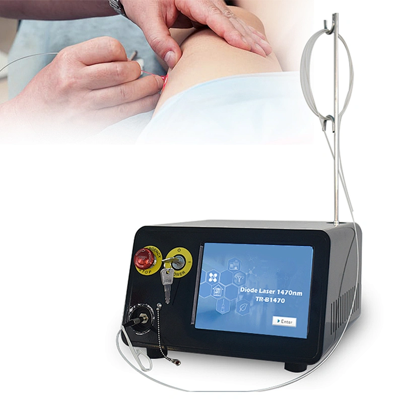 Professional Medical 1470nm 17W EVLT EVLA Diode Laser Treatment Varicose Veins Device Spider Veins Vascular Removal Machine