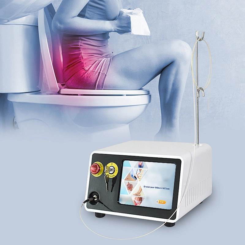 980nm 1470nm Hemorrhoidsurgery Haemorrhoids  Piles Fissure and Fistula Laser Machine