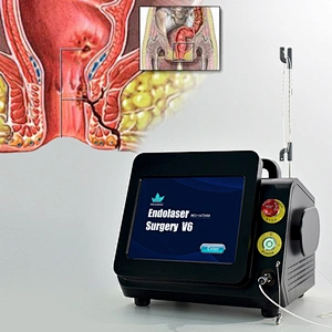 Diode Laser Dual 980nm 1470nm Hemorrhoidectomy Laser for Proctologist/Proctology