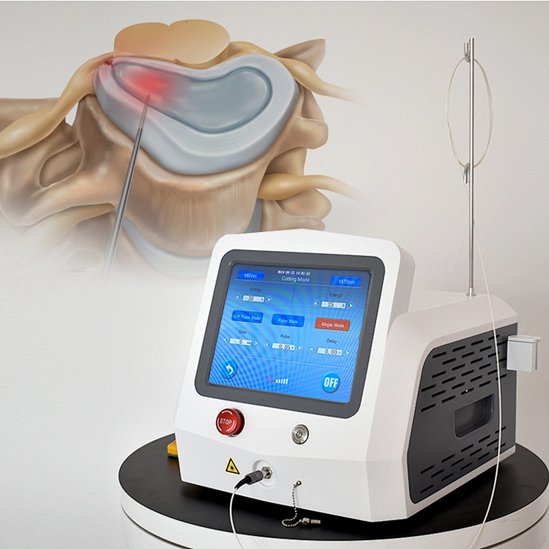 1470nm Laser Diode Physical Therapy Body Pain Relief Machine  PLDD Therapy Laser Machine
