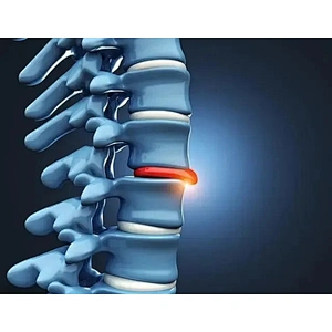 2024 Latest Medical Diode Surgical Pldd 980nm 1470nm Laser Machine for Percutaneous Laser Disc Decompression