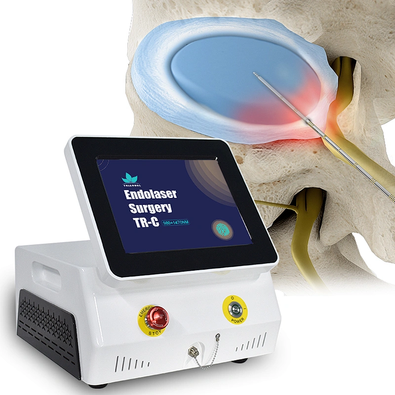 High Quality PLDD Laser Treatment  Diode Lase 980nm 1470nm Equipment Used for PLDD
