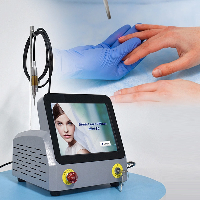 2025 Triangel Hot Sale 30w Podiatry Laser Treatment Machine 980nm Diode Laser Nail Fungus Treatment Device