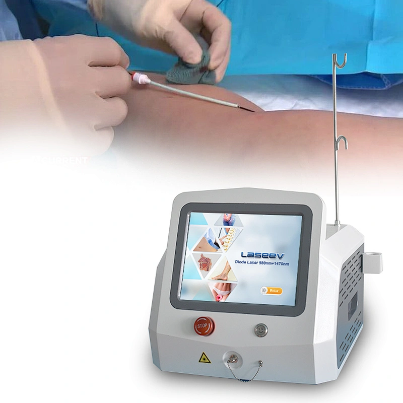 Radial Laser Fiber EVLT Varicose Vein Removal 1470nm 1940nm Laser Wavelenth Machine