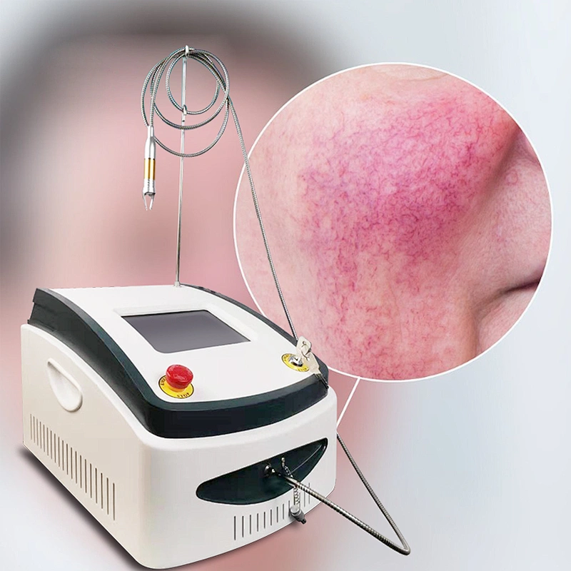 60W 980nm Diode Laser Vascular Therapy Vein Removal Machine Beauty Vascular Removal Capillaries Blood Vessels