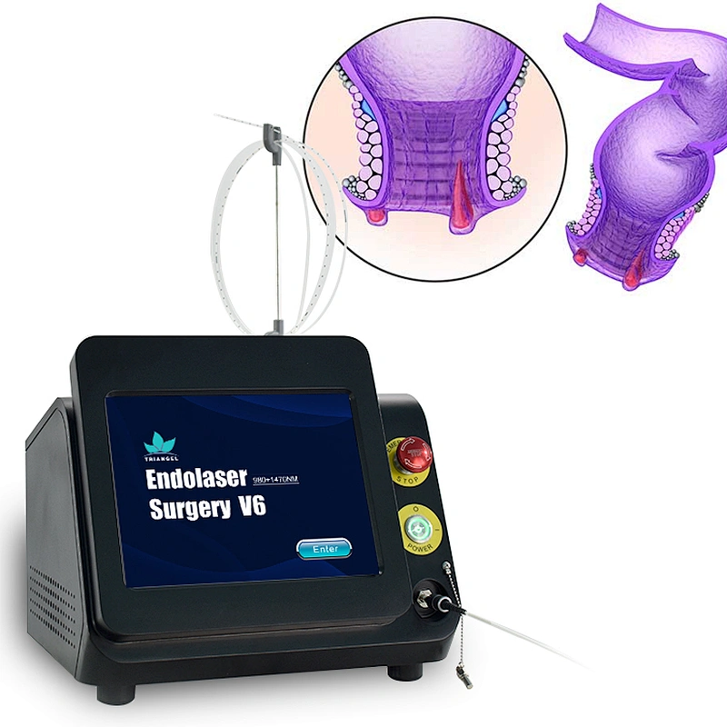 980nm 1470nm  Hemorrhoid Removal Laser  Machine Anal Fistula Haemorrhoids Laser Treatment