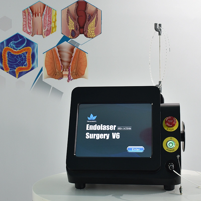 980nm1470nm Minimally Invasive Proctology Treatment Device Diode Laser Removal Hemorrhoids & Anal Fistula