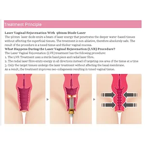 Woman Care Laser Class 4 Gynecological Surgical 980nm 1470nm Diode Vaginal Tightening Rejuvenation Gynecology Medical Machine