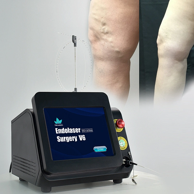 New arrival  EVLT laser 980nm1470nm endovenous laser treatment varicose vein laser
