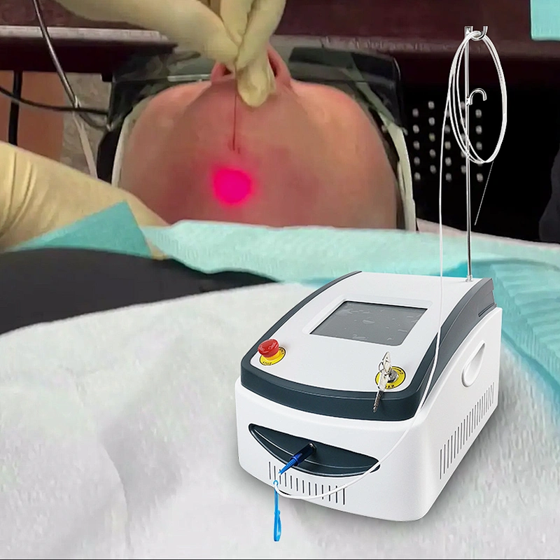 2023 Most Popular 980nm Facelift Bodycontouring Liposuction Lipolysis Machine
