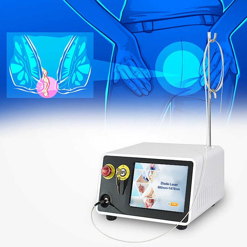 Hemorrhoidectomy Laser Surgery 1470nm 980nm Hemorrhoids Laser Treatment Proctology Laser