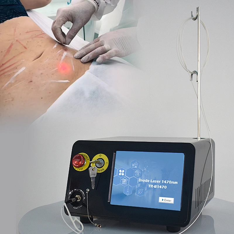 2025 Newest Liposuction Machine 980nm 1470nm Diode Laser Endolaser Facial Lifting