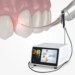 Dual Wave 810nm 980nm 1470nm Diode Laser Therapy Dental Soft Tissue Laser Machine