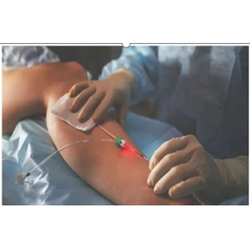 Surgical Diode Laser 980nm 1470nm Phlebology Veins Endovenous Ablation Laser Therapy