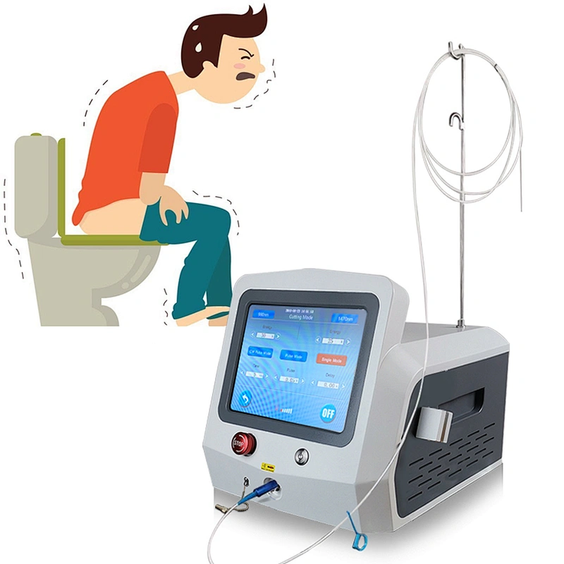 980nm1470nm Hemorrhoids Laser Proctology Surgery Germany Laser Emitter Fistula Laser Device