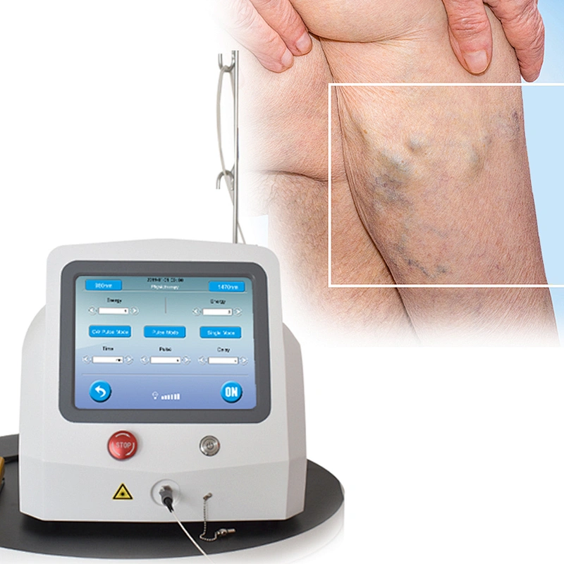 Varicose Veins Laser Treatment Machine 980nm Diode Laser 1470nm Removal Varicose Vein Device