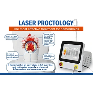 2024 Hot Seller 980nm 60w Diode Laser for Hemorrhoids Laser Fistula Treatment