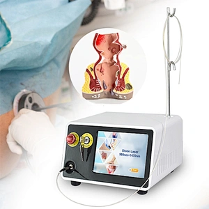 980nm 1470nm Hemorrhoid Laser Surgery Diode Laser Treatment Proctology Hemorrhoid