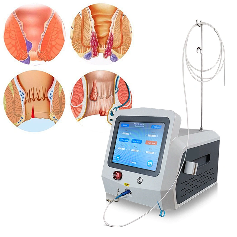 Anal Fistula Internal External Hemorrhoids Remover Piles Laser Radial Fiber 980nm 1470nm Piles Surgical Laser Instrument