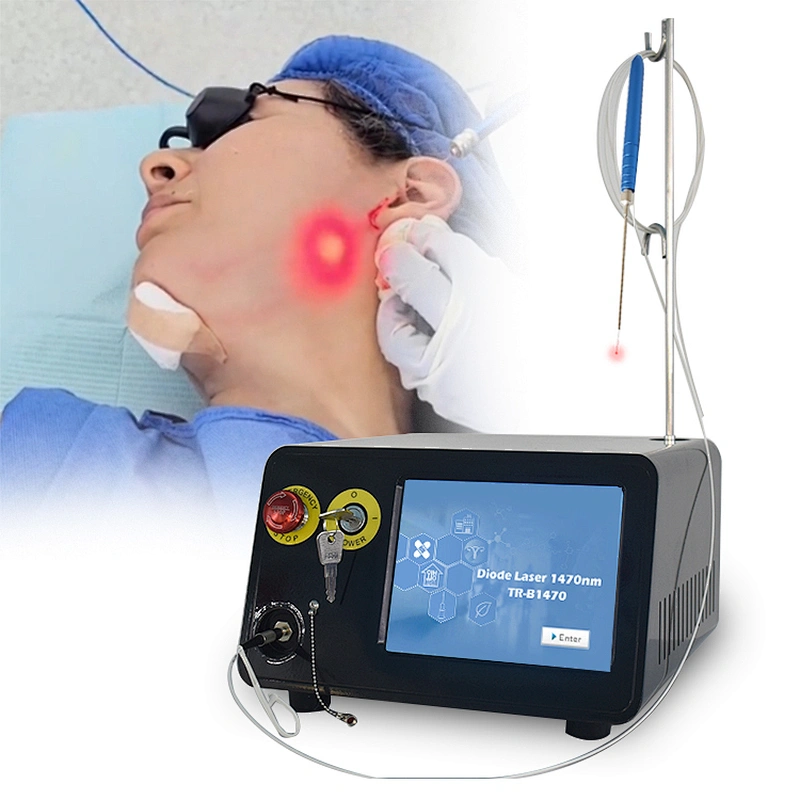 Endo Laser Diodo  Lipo Laser Machine 1470 Lipolysis Laser Fibra Endolaser Lipolise Lift