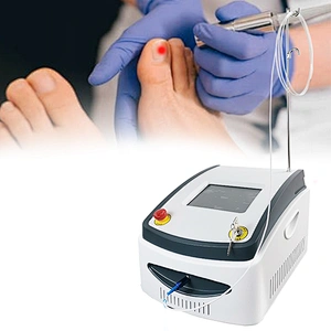 980nm Diode Laser Onychomycosis Nail Fungus Treatment Laser Onychomycosis Removal  Device