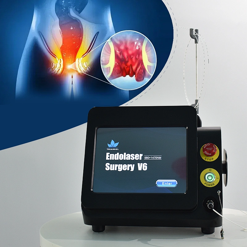Anal Fistula and Hemorrhoids Fiber Laser Equipment Anal Piles Fistula Fissure and Pilonidal Sinus Diode 980nm 1470nm