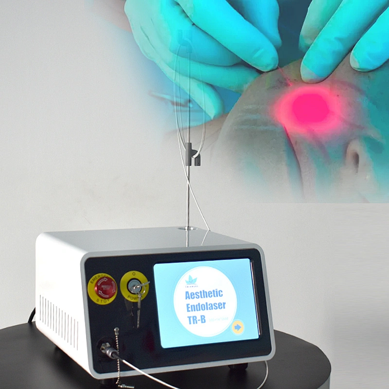 Fiberlifting Lipolysis Surgical Equipment 980nm+1470nm Diode Laser Liposuction Endolaser Lifting