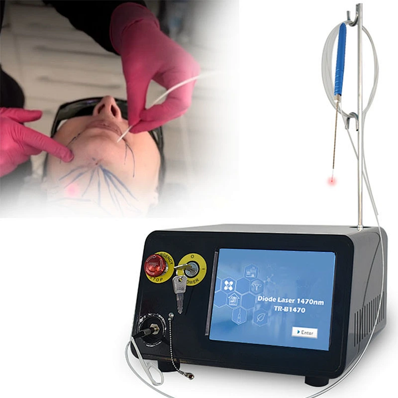 Diode Laser Surgery Liposuction Machine 1470nm 15W Power Skin Tightening Body Shaping Liposuction Removal Papada Laser Device