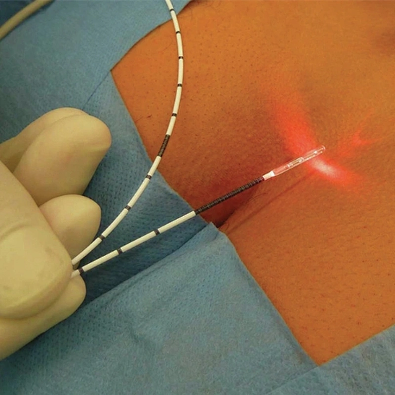 1470 Diode Laser Spider Proctology Hemorrhoids 980nm Laser Device for Large Varicose Veins Laser Evlt