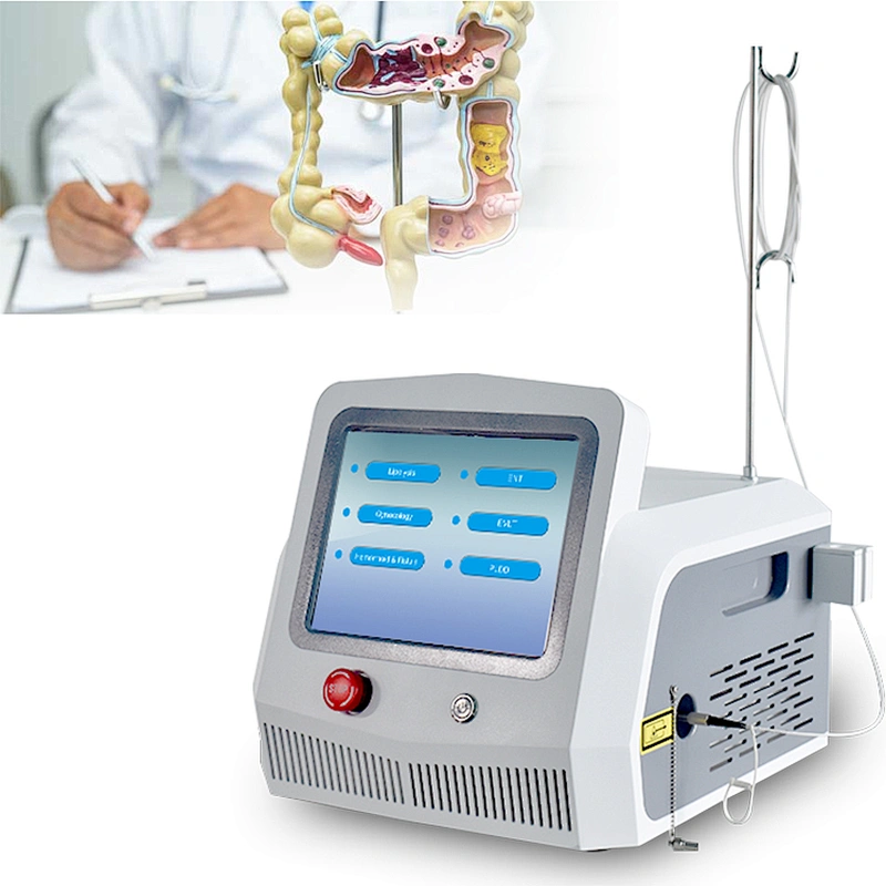 Hemorrhoids Treatment Surgery Laser Diode 980nm+1470nm Removal Piles  Hemorrhoids Anal Fistula Proctology  Laser Device