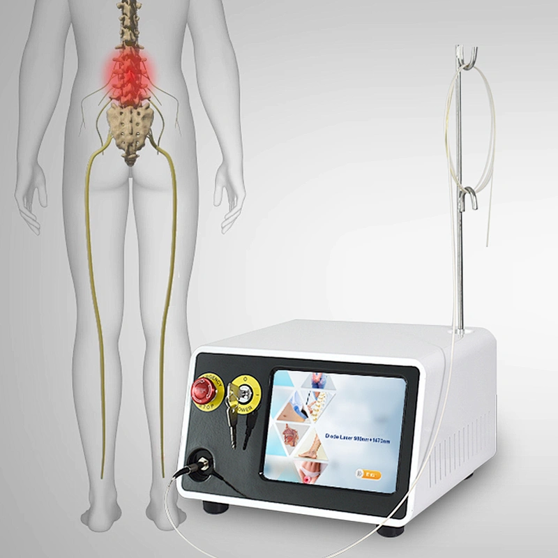 Class IV 2024 New Design 980nm/1470nm Diode Laser PLDD Treatment Machine