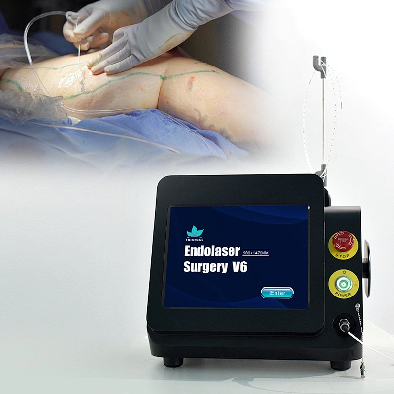 High quality radial fiber varicose veins 980nm diode laser 30w mini-invisive laser machine for evlt fibra radial