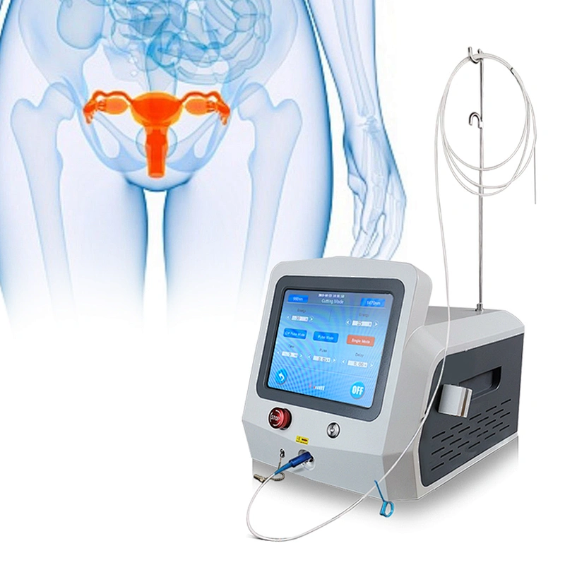 Diode Laser 980nm1470nm Minimally Invasive Gynecology Surgery Instruments for Vaginal Tightening and Vaginal Rejuvenation