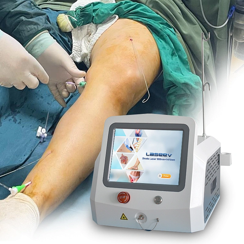 Radial Laser Fiber EVLT Varicose Vein Removal 1470nm 1940nm Laser Wavelenth Machine