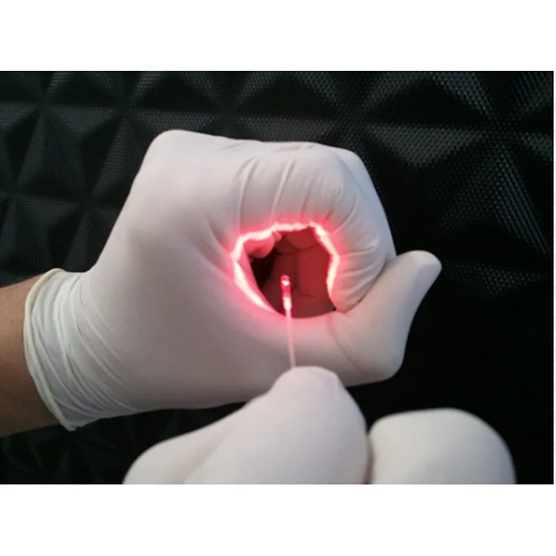 On Sale ! SMA 905 300um 400um 600um EndoSkin Endo Laser Fiber Optical Face Lifting Fiber