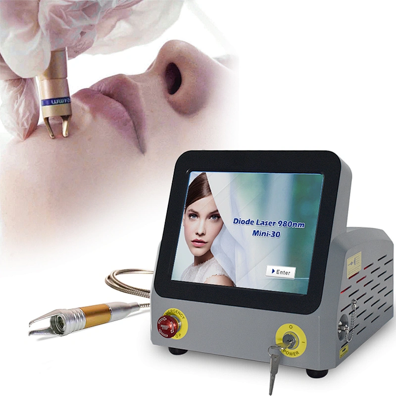 Portable Non-invasive Spider Vein Vascular Diode Laser Vascular Removal 980nm Laser Vascular Removal Machine