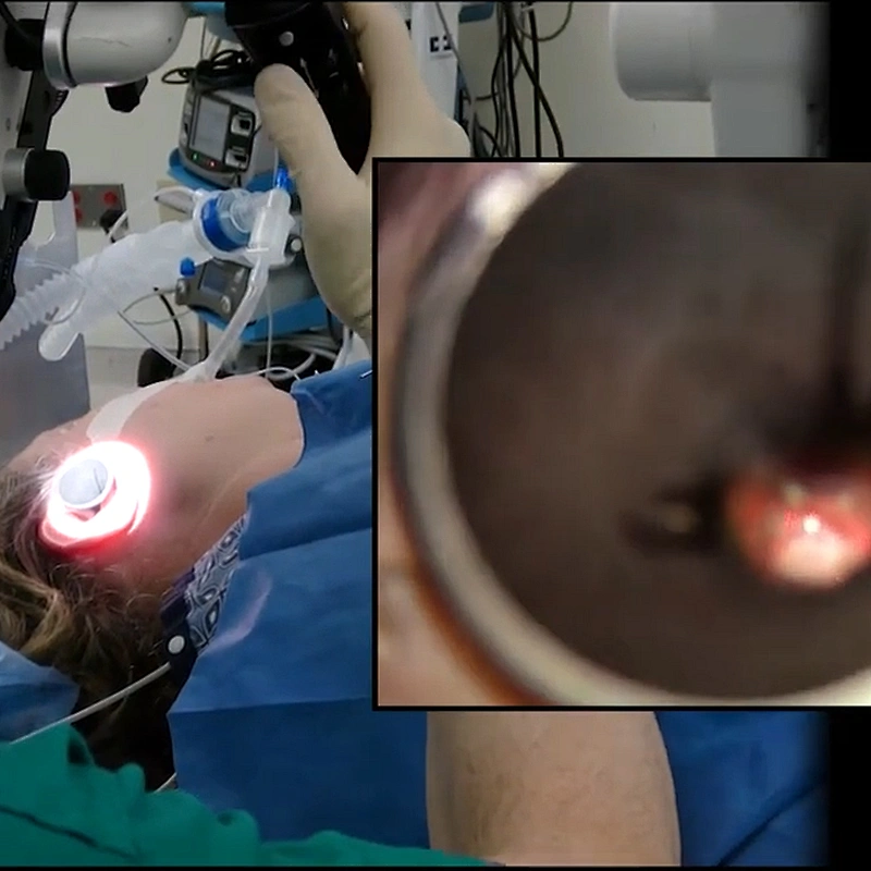 Highly Efficient Medical Surgery 980nm1470nm  ENT Laser Diode