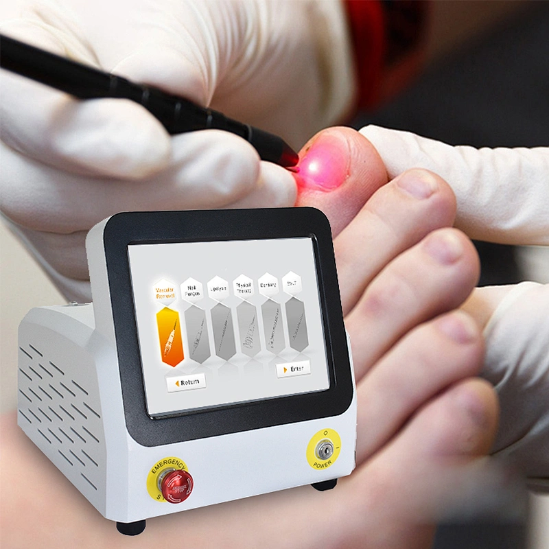 Professional Podiatry Podiatrist Doctor Use Nail Fungus Onychomycosis Laser 980nm 1064nm Fungal Nail Laser Machine