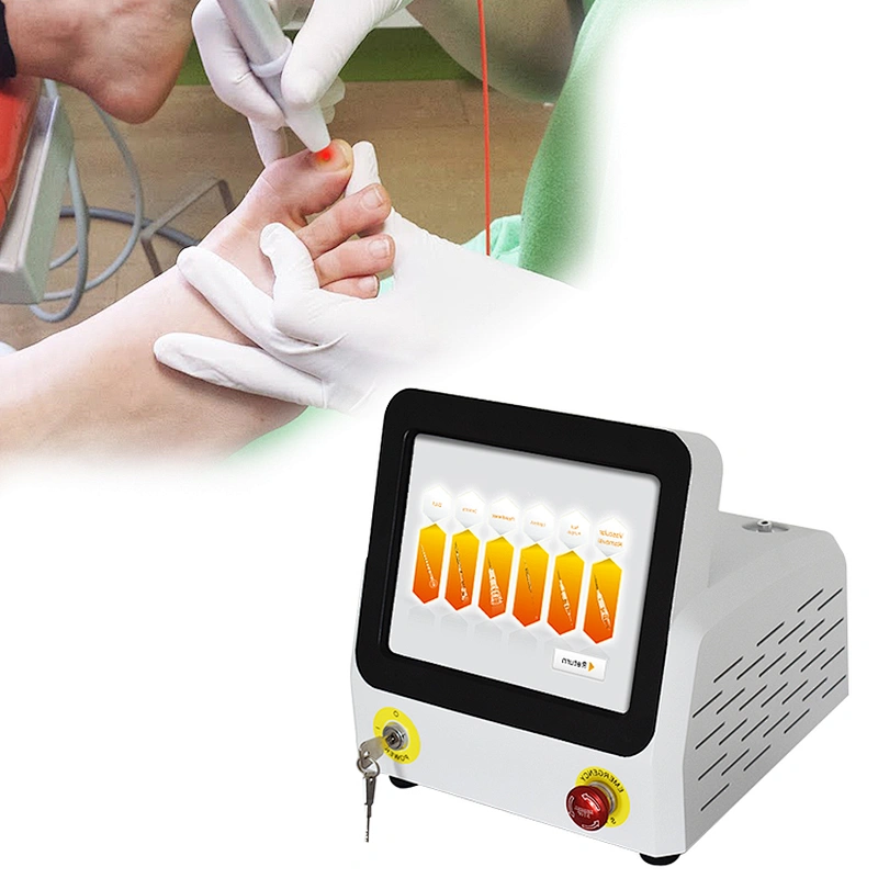 Class IV 980nm Fungus Nail Removal Laser Machine Diode Laser Treatment Podiatry Onychomycosis